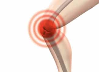 Kako izliječiti artritis na prirodan način?