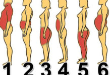 Od čega dolazi VAŠ problem s težinom i što točno napraviti: Pronađite svoj tip na ovoj mapi!