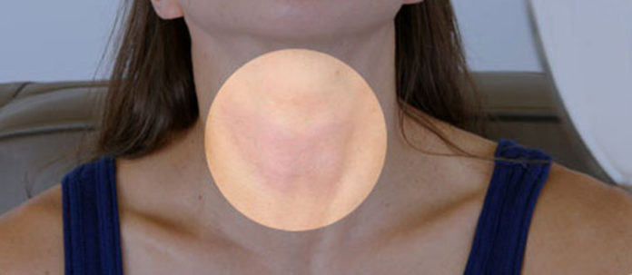 thyroid-symptoms-and-solutions-s13