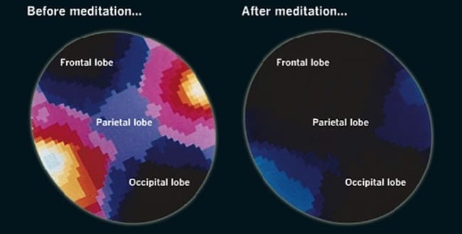 meditacija
