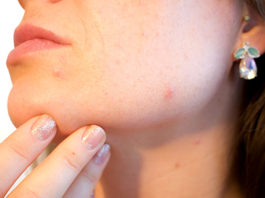 Saznajte što vaše tijelo treba prema poziciji akni