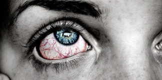 Nedostatak vitamina B12 u organizmu: Nemojte ignorirati ovih 7 simptoma!