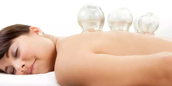 cupping