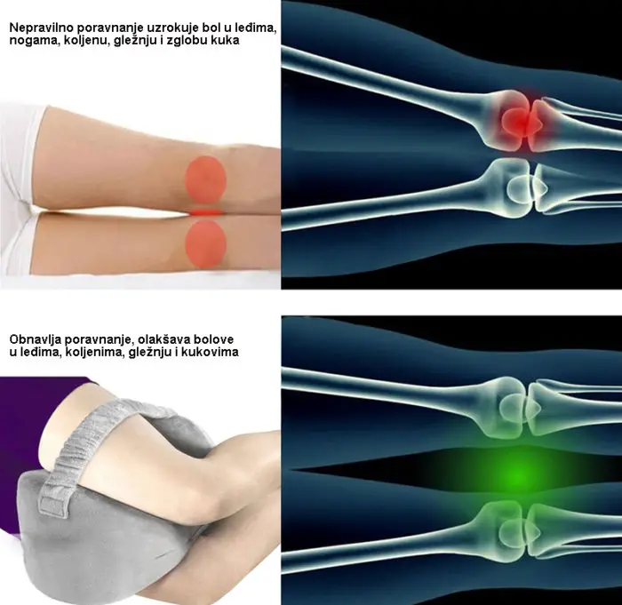 bol tijekom spavanja u zglobu kuka najbolje metode liječenja artroze