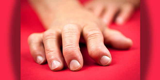 mag za liječenje artritisa zglavci upaljeno ruku