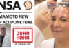 YNSA – Yamamoto new scalp acupuncture by Juan Hahn