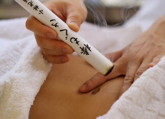 Seminar: Indirektna moksibustija